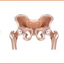 고관절 통증 원인은? 고관절에 좋은 운동 이미지