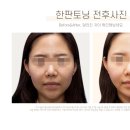 백석하나의원 네이버블로그