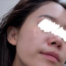 가야로 183(롯데리아 김해북부점) 앞 | 김해 삼계동 피부관리 빈스뷰티에서 물방울관리 재방문후기