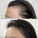 뷰티헤어라인 이미지