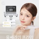 강남성원의원 | 강남 울쎄라피프라임 신규런칭, 기존 리프팅 차이 효과 후기