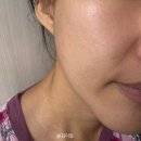 집중짱바둑교실(B) | 뷰티디바이스 홈케어 추천 셀비전 쎄라쥬 사용법 내돈내산 후기