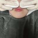 홈플러스 맞은편 보도 | 부산 광안리 토탈뷰티샵 BBB비비비 페이스라인(리프팅) 받고 온 후기