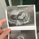 대치성모여성의원 | 서리풀성모여성의원 서브병원 초음파 방배역 산부인과 마미톡