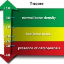 최진의원 이미지
