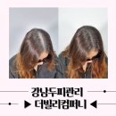 구로-현장-구로-1767 | 강남두피관리 더빌리컴퍼니 정수리 탈모커버