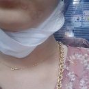 메어리벳의원 | 메어리벳의원 점빼기 후기, 점빼고 난 후 관리(노스카나겔, 더마틱스울트라)