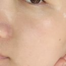 에스투메디칼 이미지