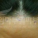 임마누엘헤어 이미지