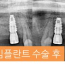 연세바른치과 이미지