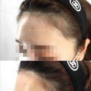 180도헤어 이미지
