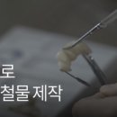 대구디지털치과기공소 이미지
