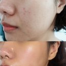 민감성 피부를 위한 셀로제 하이드라 리프팅 부스터 앰플 1주일 사용후기