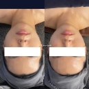 상봉빌딩 | 중랑구피부관리 상봉피부관리 망우피부관리 에스테티아망우역점 윤곽관리 후기