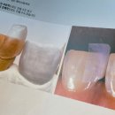 매직치과기공소 | 서면라미네이트 플래티네이트 상담다녀왔어요 :-)