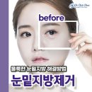 마스크성형외과의원 티스토리