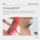 아이즈온유 | 언더속눈썹펌, 전후 효과부터 유지기간·시술시간까지 완벽 정리 (아이즈온유파주운정점)