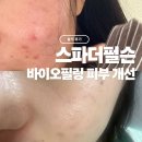 (주)바이오포스 | 영등포피부관리 여드름 피부는 스파더펄슨 리바이브듀얼필링
