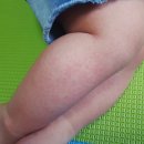 예일소아청소년과의원 네이버블로그