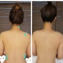 대전 에스테틱 추천 | 서인에스테틱 리프팅 관리로 어깨교정+얼굴라인 정리까지 한 번에!