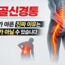 좌골신경통(Sciatica) 다리가 아픈 이유, 정말 허리 디스크 때문일까요? 이미지