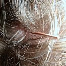 안정한의원 | 만성 찌뿌둥함 탈출 급선무! 강북안정한의원 다녀온 썰 푼다