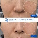 누보드스킨