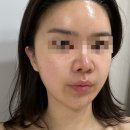 물빛스킨케어