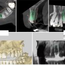 연치과기공소 이미지