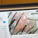 진*기 | 두피 뾰루지+각질+붉은기예민해진 두피 차홍 두피케어 후기