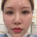 동양메디컬 | 환절기 거칠어진 피부에 딱, 수원 풀페이스 왁싱 후기