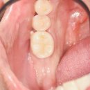 애플치과기공소 이미지