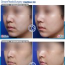 100세동안 이미지