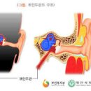 귀 이명 원인 진단 이명에 좋은 음식 이미지