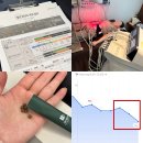 안녕한의원 | 잠실 다이어트 한의원 다이어트환 한달 후기 -5kg (1탄, 보통에서 마름)