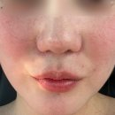청담한의원 | 자율신경실조증 청담한의원 감정홍조 도침 후기