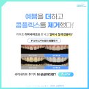 스마일라인치과기공소 이미지