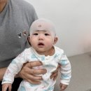 고려에이스비뇨기과의원 | 에이스밴드 가든파이브 두상교정헬멧 계약 후기 및 추천인코드 할인코드 주차정보 (2편)