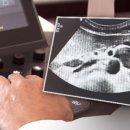 호두까기 이미지