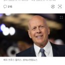 치매 ㅡ 20년전부터 시작된다 이미지