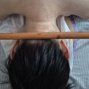 구로디지털단지역 5번 출입구 | 영등포 피부관리 추천 에이치테라피 뱀부 등케어 후기