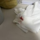 (주)가피바이오 | 코안이 코가 건조할때 마를때 비강건조증