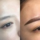 서울성형외과의원 이미지