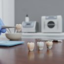 Q대를넘어서 | 앞니크라운 가격부터 재료 선택까지, 솔직한 내돈내산 후기