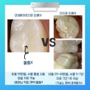 화이트디지털치과기공소 이미지