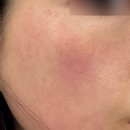 닥터이레이저피부과의원 이미지