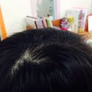 아베모헤어 | 머리카락 굵어지는법, 머리안빠지는 샴푸 : 아벨모