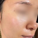 케이제이컴퍼니 | 예민피부 필오프팩 추천, 노워터 브이에쉬 글로우 더마랩 후기