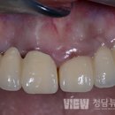 청담치과기공소 이미지
