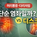 허리가 삐었을 때, 단순 염좌일까? 요추 염좌·디스크·협착증 감별법 총정리 이미지